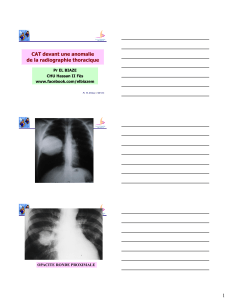 CAT devant une anomalie de la radiographie thoracique Pr EL BIAZE
