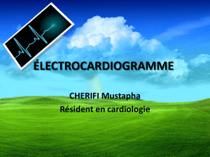 ÉLECTROCARDIOGRAMME CHERIFI Mustapha Résident en cardiologie