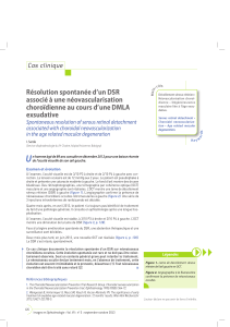 Résolution spontanée d’un DSR associé à une néovascularisation Cas clinique