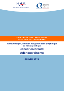 Cancer colorectal Adénocarcinome  Janvier 2012