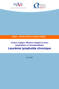 Leucémie lymphoïde chronique  Tumeur maligne, affection maligne du tissu lymphatique ou hématopoïétique