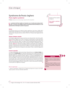 L Syndrome de Peutz-Jeghers Cas clinique Peutz-Jeghers syndrome