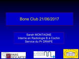 Bone Club 21/06/2017 Sarah MONTAGNE Interne en Radiologie B à Cochin