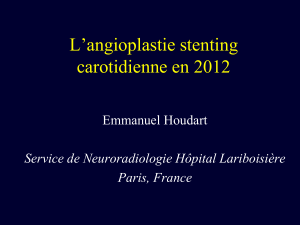 L’angioplastie stenting carotidienne en 2012 Emmanuel Houdart