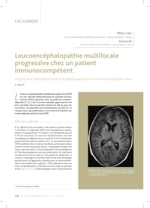 L Leucoencéphalopathie multifocale progressive chez un patient immunocompétent