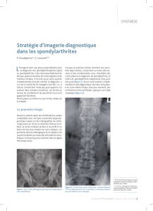 L’ Stratégie d’imagerie diagnostique   dans les spondylarthrites SYNTHÈSE