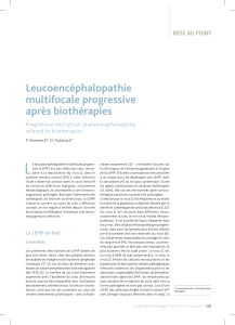 L Leucoencéphalopathie multifocale progressive après biothérapies