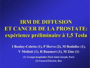 IRM DE DIFFUSION ET CANCER DE LA PROSTATE: exp é