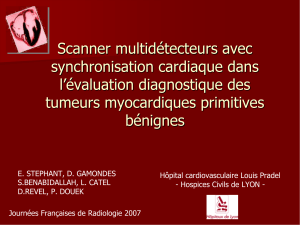 Scanner multid é tecteurs