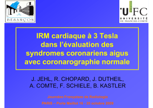 IRM cardiaque à 3 Tesla dans l’évaluation des syndromes coronariens aigus