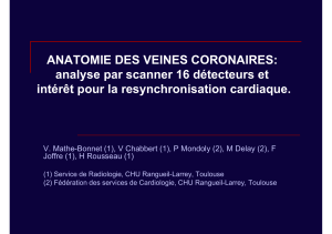 ANATOMIE DES VEINES CORONAIRES: analyse par scanner 16 détecteurs et