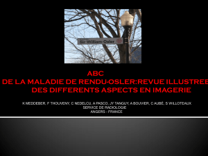 ABC DE LA MALADIE DE RENDU-OSLER:REVUE ILLUSTREE DES DIFFERENTS ASPECTS EN IMAGERIE