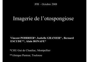 Imagerie de l’otospongiose Vincent POIRRIER*, Isabelle GRANIER* , Bernard ESCUDE**, Alain BONAFE*
