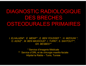 DIAGNOSTIC RADIOLOGIQUE DES BRECHES OSTEODURALES PRIMAIRES