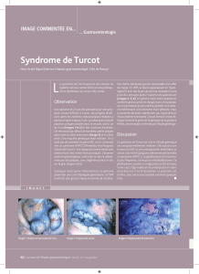 L Syndrome de Turcot IMAGE COMMENTÉE EN...