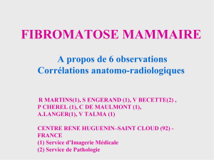 FIBROMATOSE MAMMAIRE A propos de 6 observations Corrélations anatomo-radiologiques