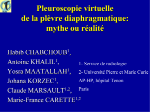 Pleuroscopie virtuelle de la pl è vre diaphragmatique: