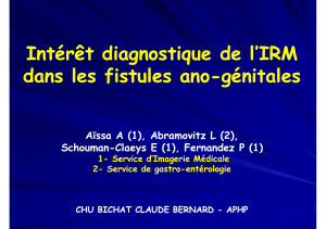 Intérêt diagnostique de l’IRM dans les fistules dans les fistules ano ano--génitales