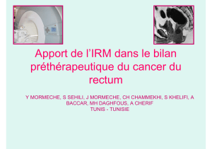 Apport de l’IRM dans le bilan préthérapeutique du cancer du rectum