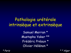 Pathologie urétérale intrinsèque et extrinsèque Samuel Merran * Mustapha Yaker **