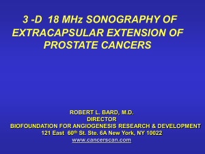 3 -D  18 MHz SONOGRAPHY OF EXTRACAPSULAR EXTENSION OF PROSTATE CANCERS