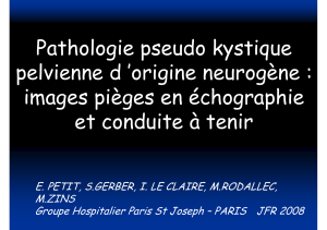 Pathologie pseudo kystique pelvienne d ’origine neurogène : images pièges en échographie