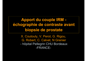 Apport du couple IRM - échographie de contraste avant biopsie de prostate