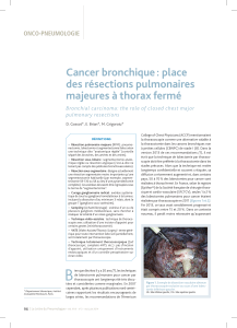 Cancer bronchique : place des résections pulmonaires majeures à thorax fermé ONCO-PNEUMOLOGIE