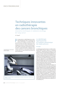 P Techniques innovantes en radiothérapie des cancers bronchiques