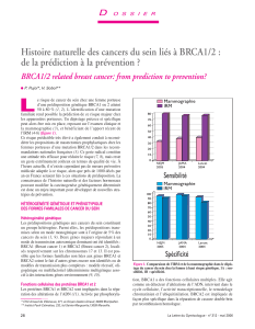 L Histoire naturelle des cancers du sein liés à BRCA1/2 :