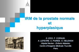 IRM de la prostate normale et hyperplasique