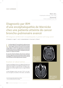 Diagnostic par IRM d’une encéphalopathie de Wernicke broncho-pulmonaire avancé