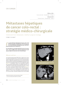 E Métastases hépatiques de cancer colo-rectal : stratégie médico-chirurgicale