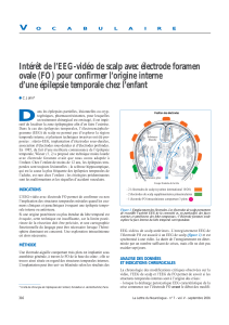 Intérêt de l’EEG-vidéo de scalp avec électrode foramen