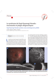 Le syndrome de Vogt-Koyanagi-Harada : nouveautés et pièges diagnostiques Focus