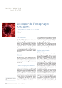 Le cancer de l’œsophage : actualités DOSSIER THÉMATIQUE Oesophageal cancer: what’s new