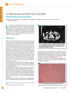 Le ﬁ brosarcome primitif de la thyroïde C