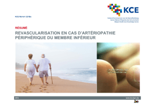 REVASCULARISATION EN CAS D’ARTÉRIOPATHIE PÉRIPHÉRIQUE DU MEMBRE INFÉRIEUR RÉSUMÉ