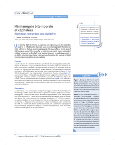 Hémianopsie bitemporale et céphalées Cas clinique Bitemporal hemianopia and headaches