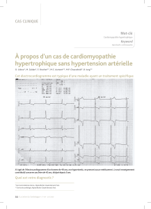 À propos d’un cas de cardiomyopathie hypertrophique sans hypertension artérielle cas clinique Mot-clé