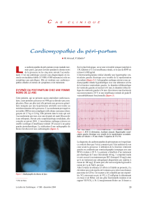 L Cardiomyopathie du péri-partum C