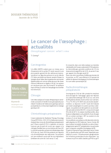 Le cancer de l’œsophage : actualités doSSiEr tHÉMatiQUE Oesophageal cancer: what’s new