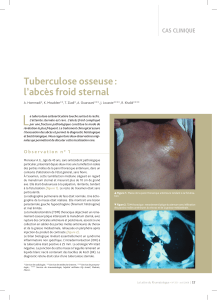 L Tuberculose osseuse : l’abcès froid sternal CaS CliNiqUE