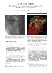 L’image du mois Fistule coronaire en imagerie non invasive L. D