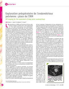 L’ Exploration préopératoire de l’endométriose pelvienne : place de l’IRM d