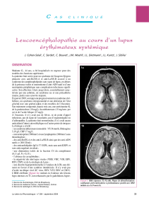 Leucoencéphalopathie au cours d’un lupus érythémateux systémique C OBSERVATION