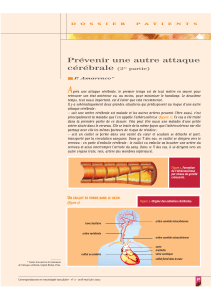 A Prévenir une autre attaque cérébrale d