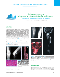 Ostéosarcomes : diagnostic et résultats du traitement