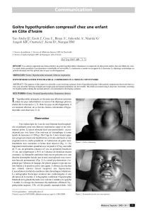 Communication Goitre hypothyroidien compressif chez une enfant en Côte d’Ivoire