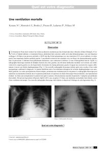 Quel est votre diagnostic Une ventilation mortelle Kenane N , Montcriol A